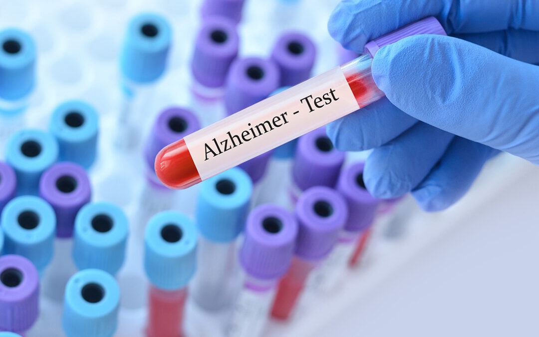 Dx Deals: Labcorp and Roche Enter into Pacts to Distribute Alzheimer’s Tests, Digitize Slides