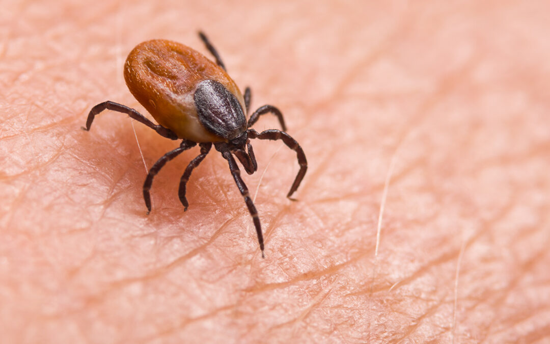 New Tests Could Make Detecting Lyme Disease Speedier and More Accurate