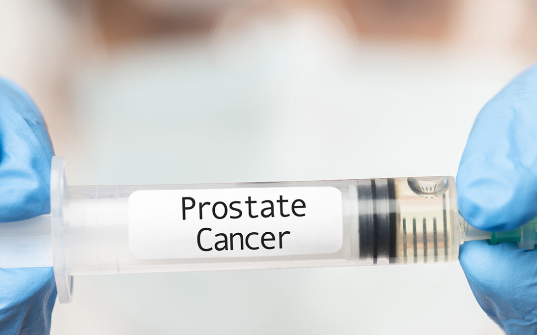 Diagnostics Pipeline: MyOme and Artera Launch New Tests for Prostate Cancer Risk