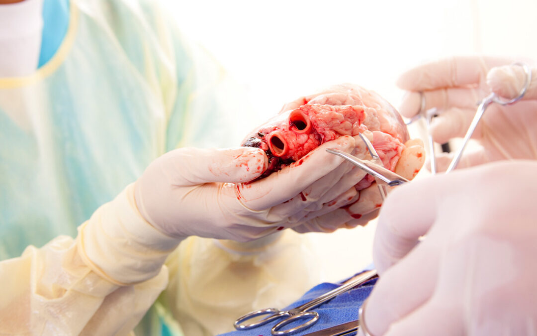 Thermo Fisher Scientific Debuts Pharmacogenetic Test to Improve Transplant Safety