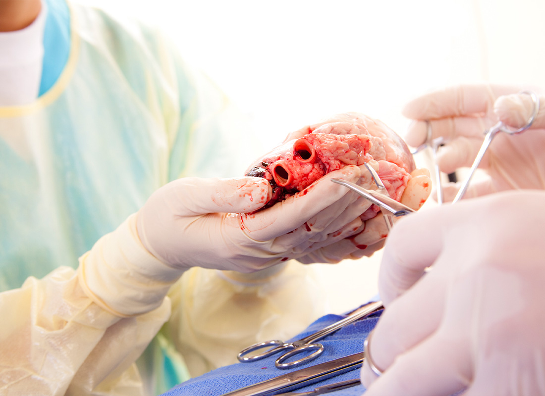 Thermo Fisher's new pharmacogenetic test helps avoid transplant complications
