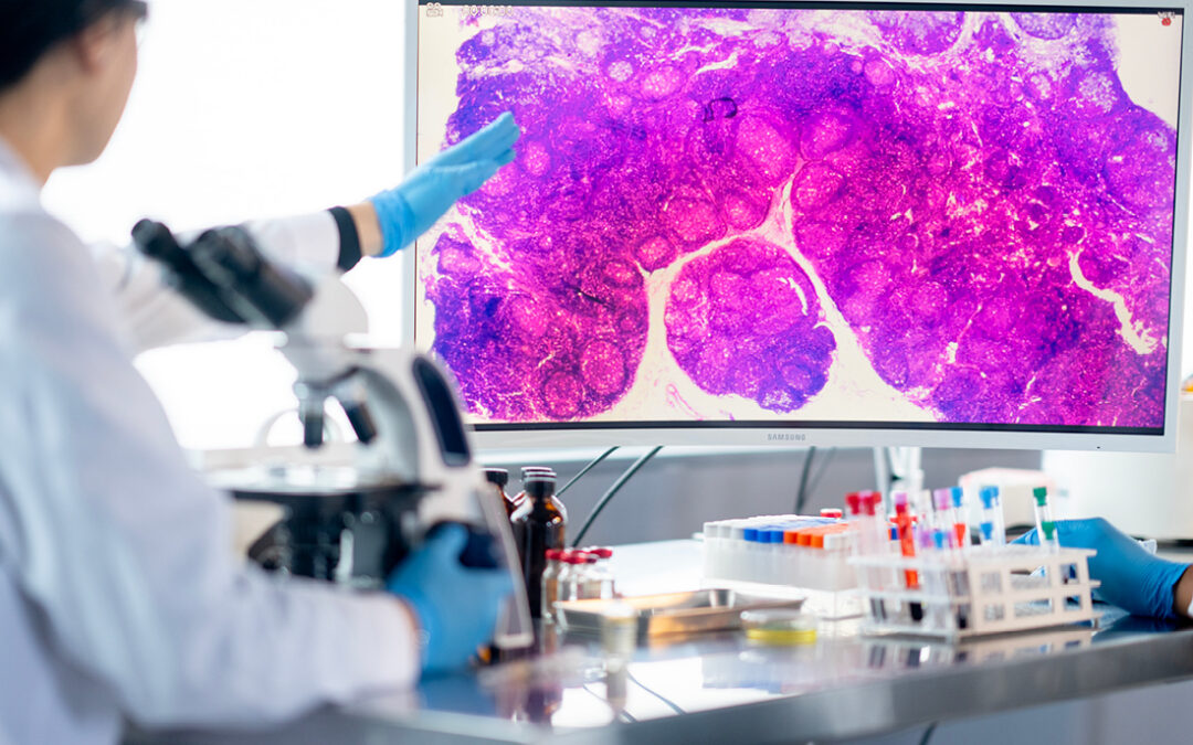 Dx Deals: Veracyte Acquires Convergent Genomics for up to $180 Million